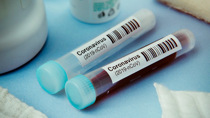 Twelve people have been tested for coronavirus in the last 24 hours COVID-19 Abkhazia